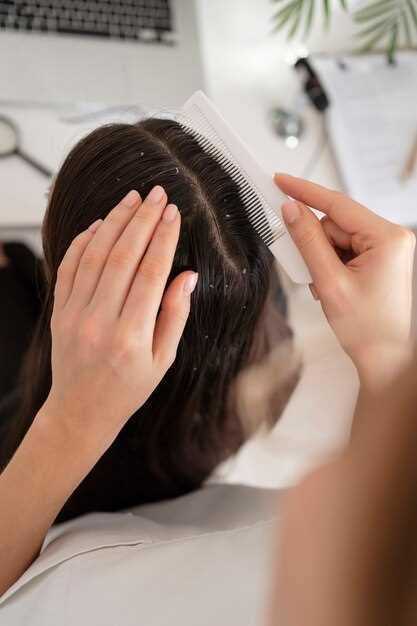 Finasteride against hair loss