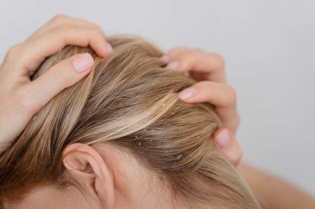Understanding Hair Loss