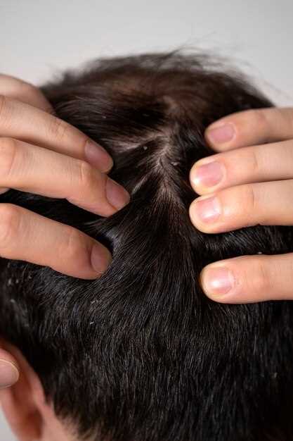 Stabilizing Hair Loss