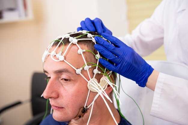 Gabapentin Treatment for Trigeminal Neuralgia