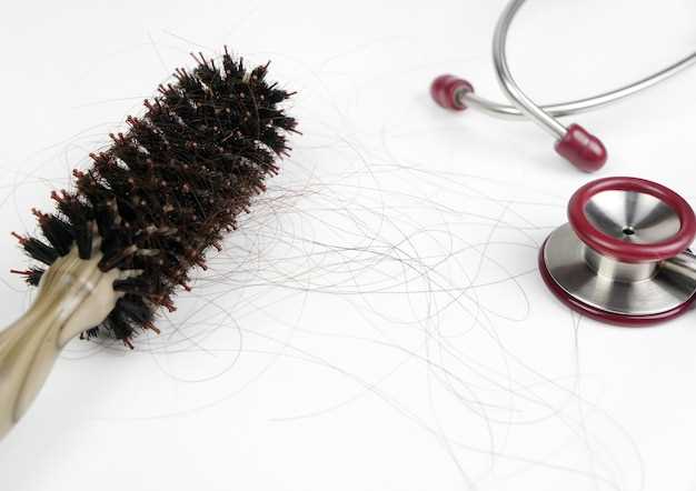 The Benefits of Topical Finasteride